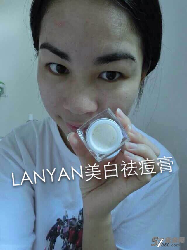 LANYAN兰硏cici祛痘膏